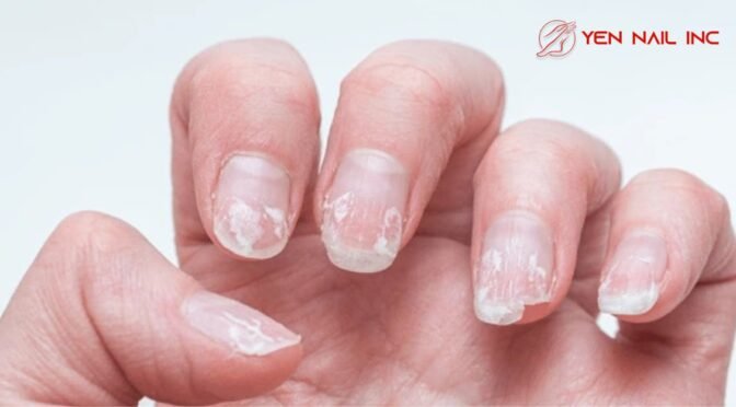 Dangers of Over-Filing Your Nails & How to Prevent It