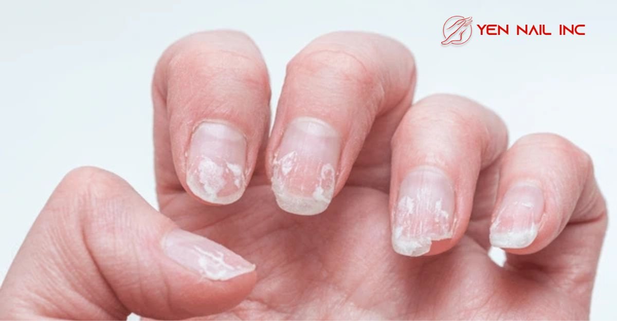 Dangers of Over-Filing Your Nails & How to Prevent It